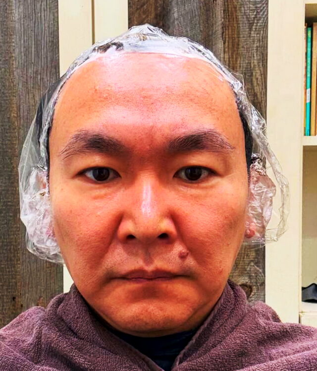 かまいたち山内をサプリメント広告で無断使用した薬局はどこか特定?肖像権違反になるのか